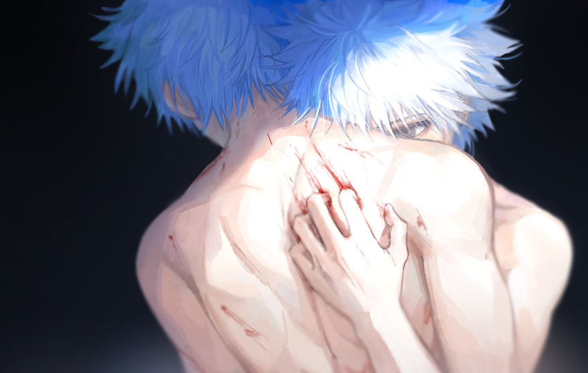 2boys black_background blood blood_on_back clone grey_eyes highres hunter_x_hunter kiko killua_zoldyck male_focus multiple_boys nude scratches scratching scratching_back simple_background spiked_hair upper_body white_hair yaoi