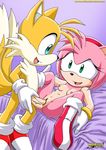  amy_rose anal anal_penetration bed breasts canine female fox gloves male miles_prower missionary_position mobian mobius_unleashed nude on_back penetration penis pink pussy sega sex smile sonic_(series) straight tails vaginal vaginal_penetration 