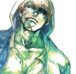  1boy bandaid bandaid_on_face blood blue_eyes blurry brown_eyes bruise bruise_on_face bruised_eye closed_mouth collarbone depth_of_field heterochromia hood hood_up injury looking_at_viewer male_focus nosebleed one_piece scar scar_on_chin scar_on_face shiso_i4 short_hair solo white_background x_drake 