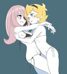  arms_around_neck bikini black_bikini blonde_hair blue_background blue_eyes bokujoukun breasts bright_pupils freckles hair_over_one_eye hairband hug little_witch_academia long_hair lotte_jansson micro_bikini multiple_girls navel one_eye_closed parted_lips pink_eyes protected_link short_hair side-tie_bikini simple_background small_breasts smile string_bikini sucy_manbavaran swimsuit wardrobe_malfunction white_legwear white_pupils yuri 