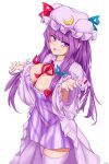  1girl absurdres blush breasts capelet cleavage cowboy_shot crescent crescent_hat_ornament d: dress eyebrows_visible_through_hair frills hands_up hat hat_ornament highres large_breasts long_hair looking_at_viewer mob_cap open_mouth pan-ooh patchouli_knowledge purple_dress purple_eyes purple_hair purple_legwear solo thighhighs touhou transparent_background very_long_hair white_capelet 