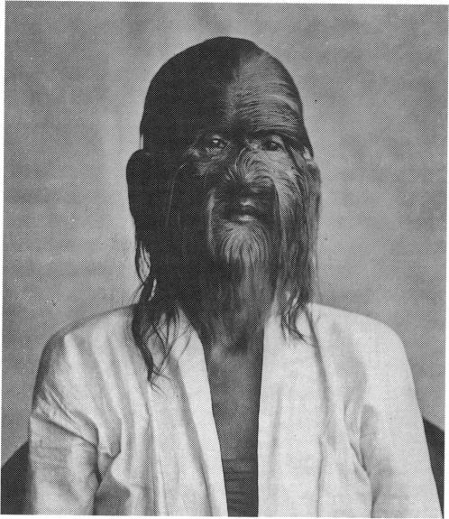 congenital_hypertrichosis_lanuginosa genetic_disorder greyscale hairy human looking_at_viewer monochrome photo portrait real solo what what_has_evolution_done