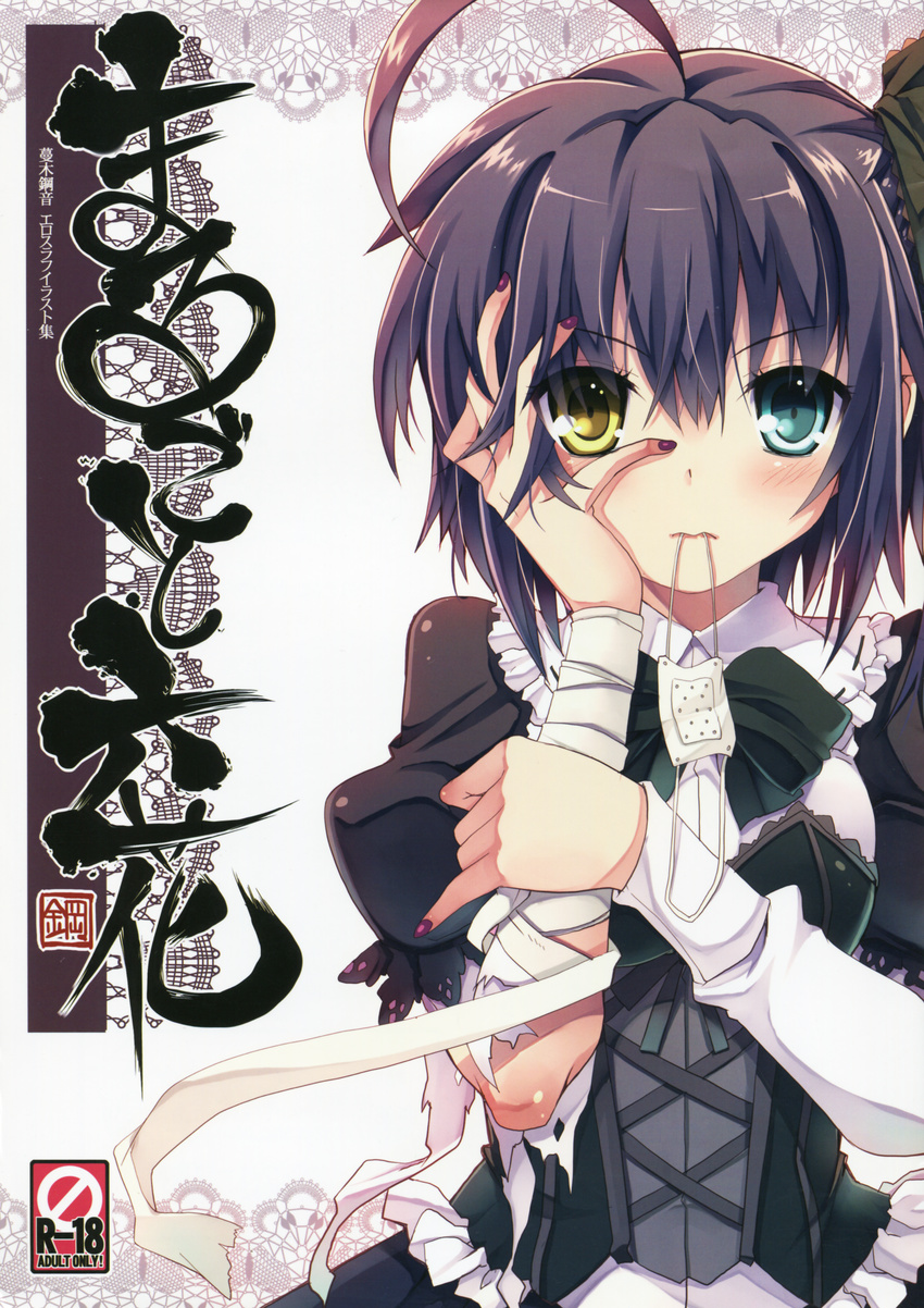 bandages chuunibyou_demo_koi_ga_shitai! gothic_lolita heterochromia lolita_fashion takanashi_rikka tsurugi_hagane