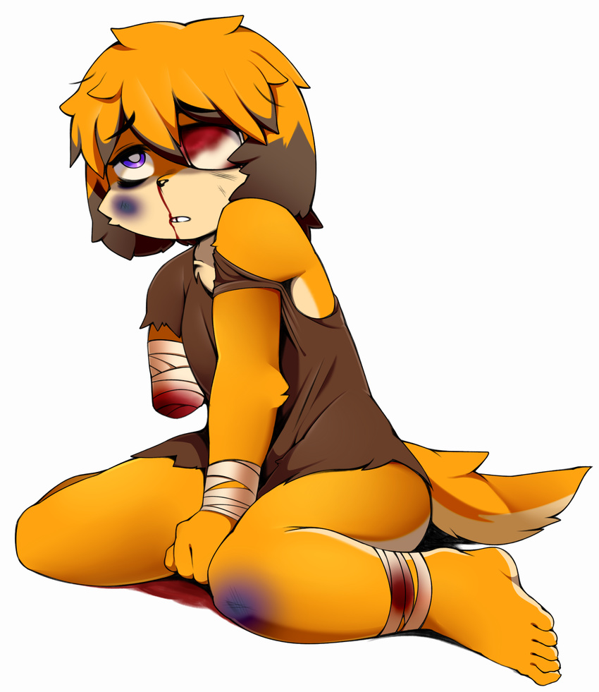 amputee anthro berseepon09 blonde_hair blood blood_on_bandage brown_fur bruised canine clothing dog eye_patch eyewear fur hair male mammal nosebleed off_shoulder orange_fur purple_eyes shirt simple_background solo white_background wounded young