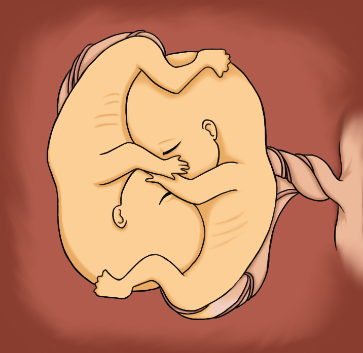 The Big ImageBoard (TBIB) - closed eyes fetus kiss siblings twins uterus 41...