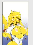  anthro clothing digital_media_(artwork) female freckles fur hi_res mammal nintendo nurse nurse_clothing nurse_uniform pikachu pok&eacute;mon pok&eacute;mon_(species) rurydrawings simple_background solo uniform video_games wardrobe_malfunction yellow_body yellow_eyes yellow_fur 