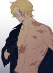  1boy bandage_on_face bandages black_gloves black_shirt blonde_hair burn_scar corrupted_twitter_file gloves highres holding kangyaosasuke long_sleeves male_focus one_piece sabo_(one_piece) scar scar_across_eye scar_on_face shirt solo 