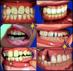  6+others absurdres artist_name blood blood_on_teeth english_commentary highres lip_pull missing_tooth mouth_focus multiple_others open_mouth original other_focus teeth thefiendkismet 