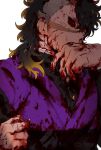  1boy biting black_hair blonde_hair blood blood_on_chest blood_on_clothes blood_on_face blood_on_hands colored_sclera colored_tips cuts demon_slayer_uniform fang fingernails flesh gohanha118 hands_up highres holding injury kimetsu_no_yaiba long_hair long_sleeves looking_away male_focus mismatched_sclera mohawk multicolored_hair open_mouth purple_vest red_sclera scar scar_on_face scar_on_nose scratches self_harm sharp_fingernails shinazugawa_genya simple_background solo streaked_hair torn_clothes upper_body vest white_background 