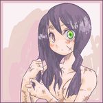  heterochromia kobushi_abiru sayonara_zetsubou_sensei scar tagme 