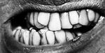  bugs crooked greyscale grinch how_the_grinch_stole_christmas human insects lips mammal monochrome not_furry photo real snarling teeth termite 