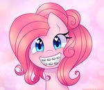  blue_eyes braces equine female feral friendship_is_magic fur hair horse joyfulinsanity long_hair looking_at_viewer mammal my_little_pony open_mouth pink_fur pink_hair pinkie_pie_(mlp) pony smile solo teeth 