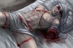  amputee artist_request bandages blood bruise double_amputee guro humanization injury long_hair male_focus metal_gear_(series) metal_gear_rising:_revengeance monsoon_(metal_gear_rising) no_mask scar silver_hair solo 