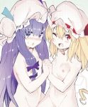  2girls ;d bad_source bangs blonde_hair blue_bow blush bow breasts cropped flandre_scarlet groin hair_between_eyes hair_bow hand_holding hat hat_ribbon highres interlocked_fingers long_hair looking_at_viewer mob_cap multiple_girls navel nipples nose_blush nude one_eye_closed open_mouth out-of-frame_censoring patchouli_knowledge purple_eyes purple_hair red_eyes ribbon sawayaka_samehada small_breasts smile sweatdrop third-party_edit touhou very_long_hair white_hat 