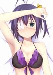  arm_on_head arm_up armpits bad_id bad_pixiv_id bed black_hair blue_eyes blush breasts chuunibyou_demo_koi_ga_shitai! cleavage clenched_teeth eyepatch h.l. lingerie looking_at_viewer lying medium_breasts nose_blush on_back one_side_up parted_lips swimsuit takanashi_rikka teeth underwear 