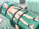  aqua_eyes aqua_hair aqua_nails aqua_pubic_hair breasts catheter censored colored_pubic_hair feet hatsune_miku highres medium_breasts mjn nail_polish nipples nude pubic_hair restrained solo twintails vocaloid 