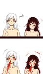  alternate_hair_length alternate_hairstyle blood blush brown_hair commentary directional_arrow kuma_(bloodycolor) looking_at_another looking_to_the_side multiple_girls nosebleed nude one_eye_closed ruby_rose rwby scar scar_across_eye weiss_schnee white_hair 