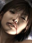  1girl abuse asian blood brown_hair bruise female freckles injury jewelry necklace nosebleed realistic solo yoshitaka_kawakami 