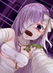  1girl bandage bandaged_arm bandaged_head bandages bare_shoulders breasts commentary_request crying crying_with_eyes_open dutch_angle erect_nipples fate/grand_order fate_(series) highres hourai_kochou kingprotea long_hair looking_at_viewer moss one_eye_covered open_mouth outstretched_arms purple_background purple_eyes purple_hair small_breasts solo strapless tears teeth tubetop underboob upper_body uvula 