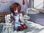  amputee bed blood bloody_clothes blue_dress brown_hair dress empty_eyes frilled_shirt_collar frills guro hair_ornament hairclip hairpin hospital_bed indoors intravenous_drip original quadruple_amputee ray-k short_dress short_hair short_sleeves sitting solo translated 