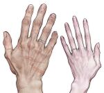  1boy 1girl conyang_316 hand_focus highres jewelry original pale_skin ring scar scar_on_hand simple_background white_background 