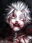  1boy absurdres blank_eyes blood blood_from_mouth blood_on_face blood_on_ground collarbone defeat dismemberment empty_eyes guro highres injury kaneki_ken lying male_focus messy_hair mutilation no_pupils on_ground open_mouth short_hair solo teeth tokyo_ghoul tokyo_ghoul:re unconscious upper_teeth_only white_eyes white_hair xa8uofivf2mcart 