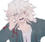  1boy bandaged_arm bandages collarbone crew_neck danganronpa_(series) danganronpa_2:_goodbye_despair green_jacket hair_between_eyes highres jacket komaeda_nagito long_sleeves male_focus messy_hair nail_polish one_eye_closed open_clothes open_jacket open_mouth print_shirt red_nails round_teeth ryousuke_(tukr5384) shirt simple_background smile solo teeth tongue upper_teeth_only white_background white_hair white_shirt 
