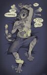 4_toes absurd_res ambiguous_anthro ambiguous_gender ankle_grab anthro begging begging_to_stop belly_pat belly_rub blue_background bottomwear claws clothed clothing disembodied_hand domestic_cat embarrassed english_text fangs feet felid feline felis forced group hi_res hindpaw jollyjersey leg_grab male male/ambiguous male_anthro mammal nipples open_mouth pawpads paws petting questionable_consent shorts shorts_only simple_background spread_toes submissive submissive_anthro submissive_male teasing teeth text tickle_fetish tickle_torture tickling tickling_belly toe_claws toes topless touching_belly trans_(lore) trans_man_(lore) wrist_grab