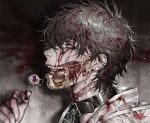  bags_under_eyes belt_collar blood blood_from_forehead blood_in_hair blood_on_clothes blood_on_face blood_stain body_horror brown_hair candy coat collar disintegration earrings ero_guro exposed_bone exposed_fat exposed_muscle eyeball food from_side guro hand_up highres jewelry licking lollipop melting multiple_earrings original portrait saliva saliva_trail see-through_clothes shinku_syrup short_hair skinned stitched_face stitched_neck stitches tongue tongue_out white_coat yellow_eyes 