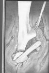  anal feet foot guro highres hiroaki_samura insertion large_insertion monochrome object_insertion pencil sandal sandals scan x-ray 